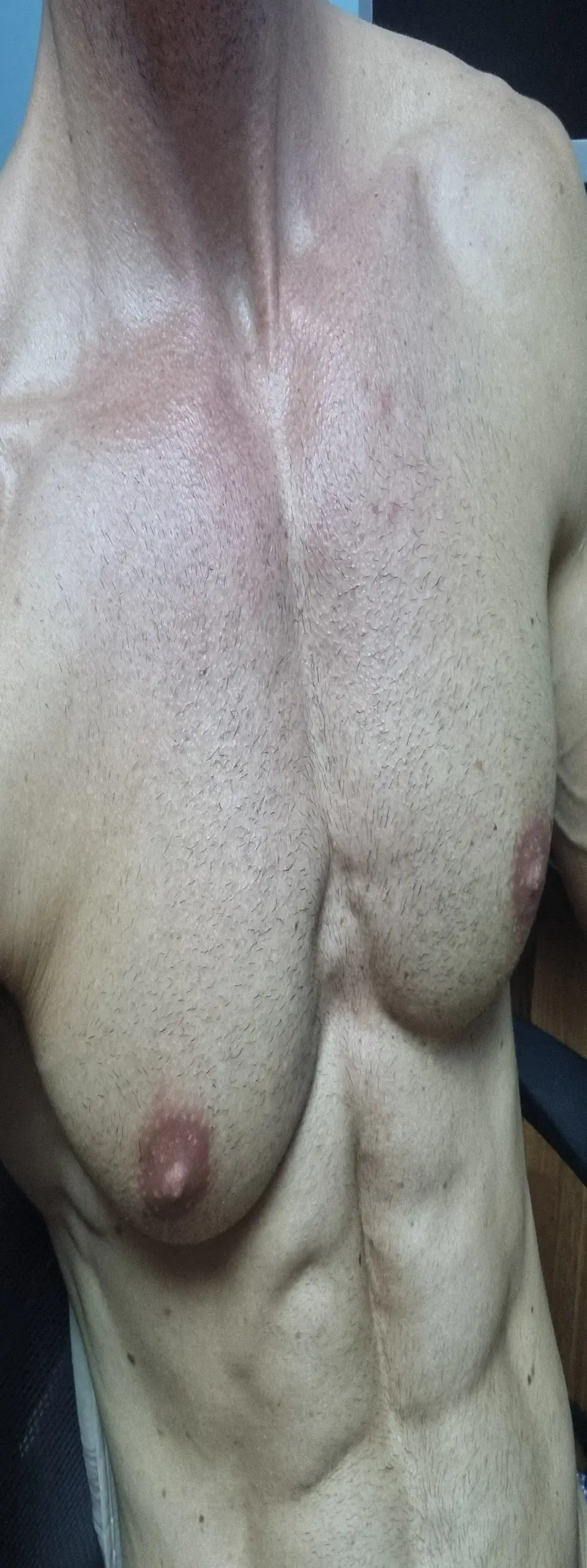 flexforyou